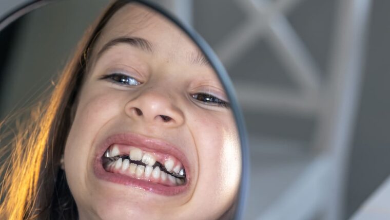 Kreivi dantys: priežastys, pasekmės ir gydymo būdai