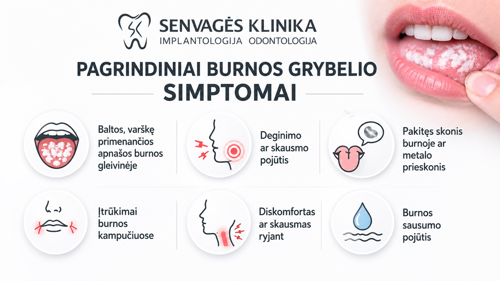 Burnos grybelis: priežastys, simptomai, gydymas ir prevencija