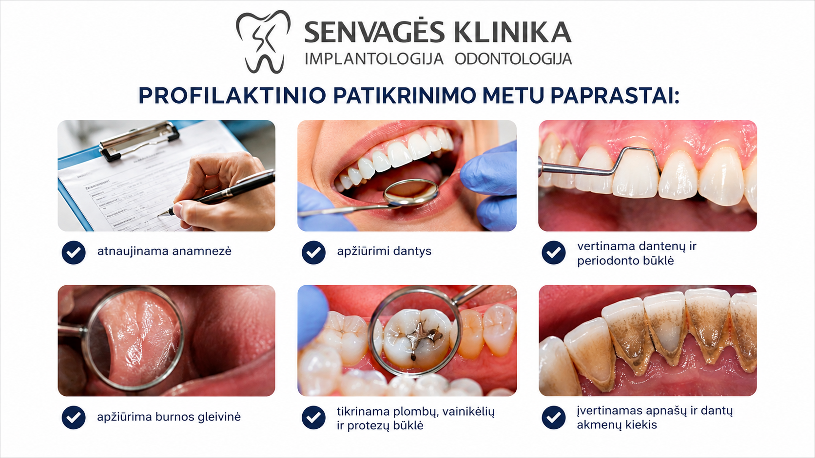 Profilaktinis dantų patikrinimas: kaip dažnai ir kas tikrinama