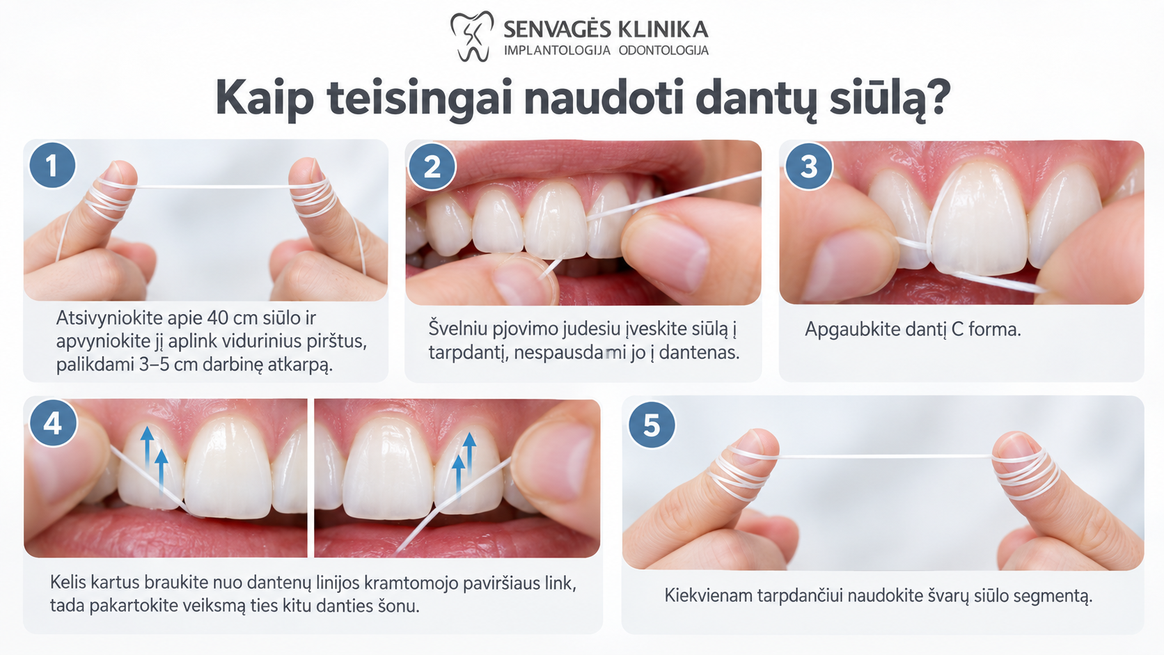 „Penkių žingsnių infografika, paaiškinanti, kaip teisingai naudoti dantų siūlą: paruošti siūlą, įvesti jį į tarpdantį, apgaubti dantį C forma, valyti abiejų dantų šonus ir naudoti švarų siūlo segmentą kiekvienam tarpdančiui.“
