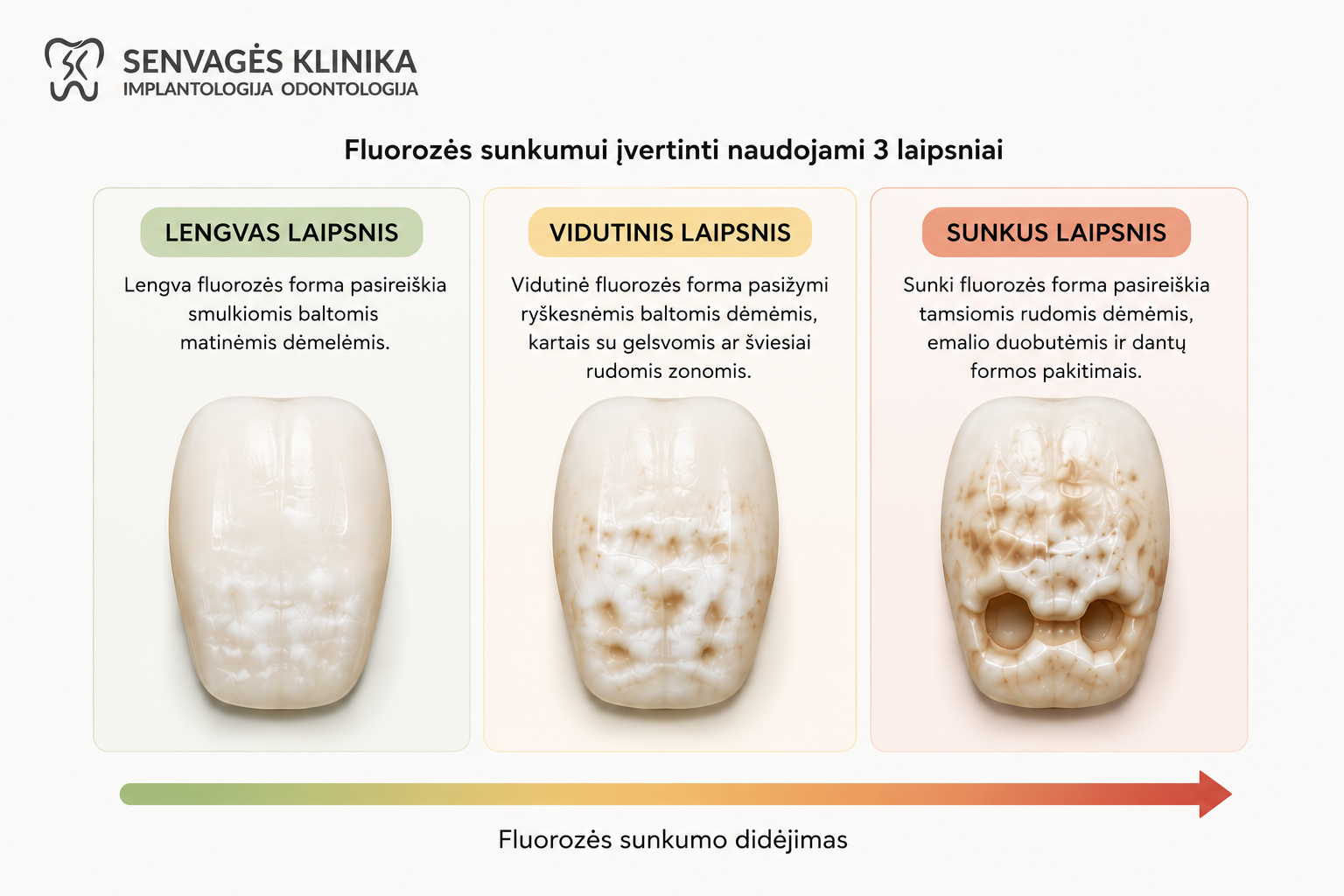 Fluorozė: priežastys, simptomai, gydymas ir profilaktika