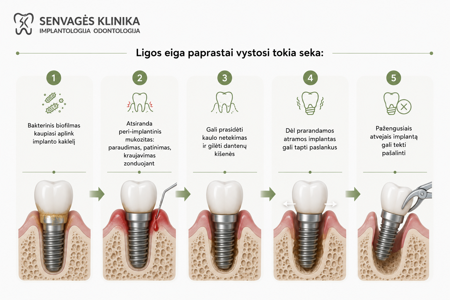 Periimplantitas: simptomai, priežastys ir gydymas