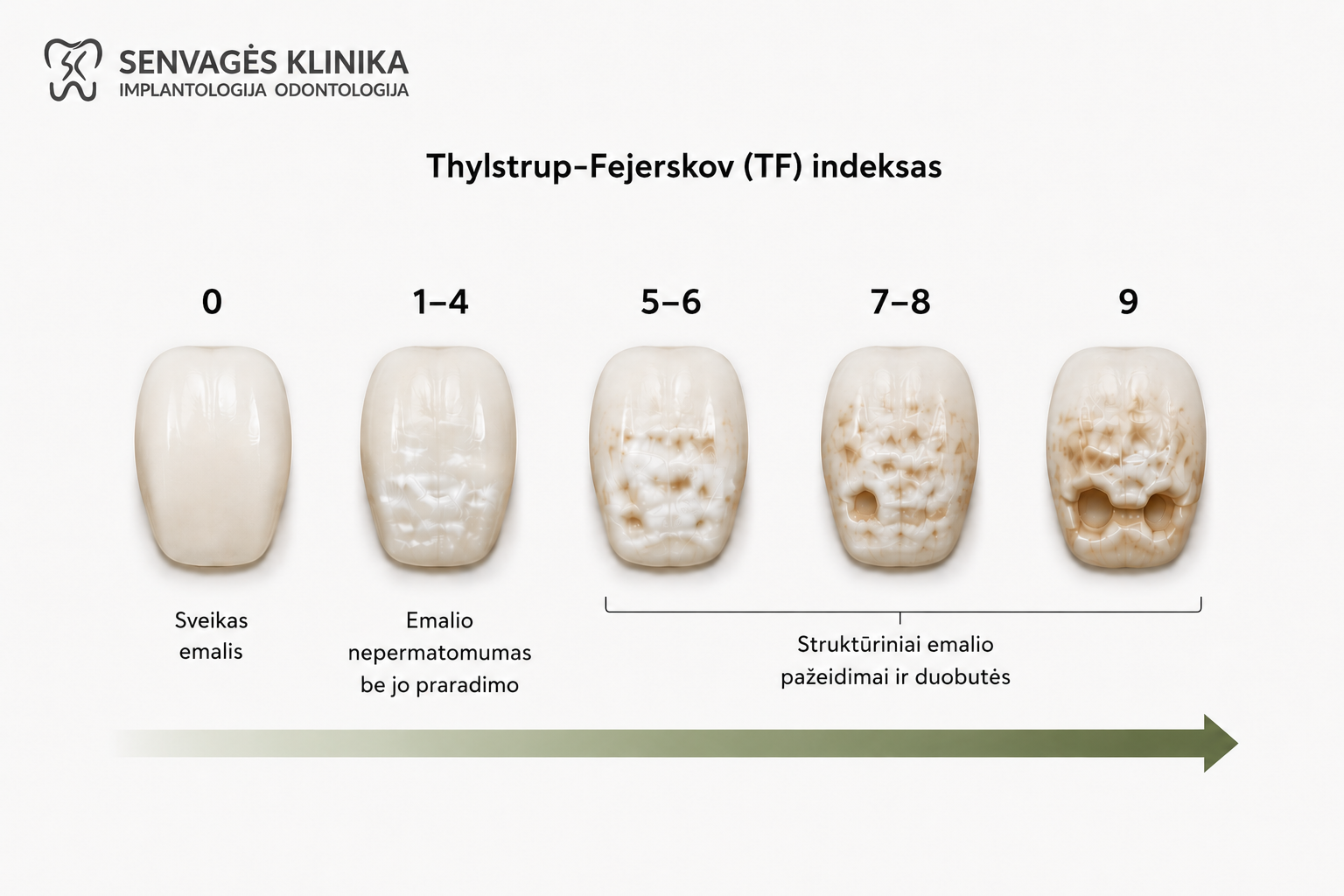 Fluorozė: priežastys, simptomai, gydymas ir profilaktika