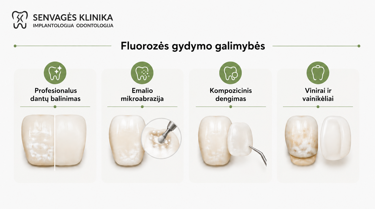 Fluorozė: priežastys, simptomai, gydymas ir profilaktika