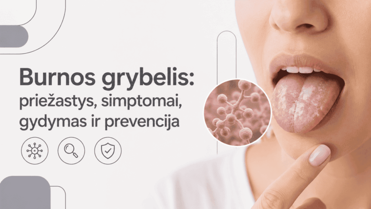 Burnos grybelis: priežastys, simptomai, gydymas ir prevencija